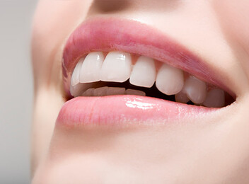 Deposit Towards Full Braces Package