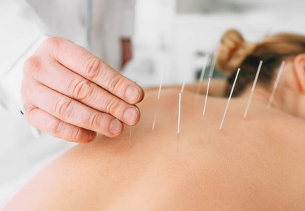 60-Minute Stress, Anxiety or Insomnia Acupuncture Session - Option for Three-Sessions