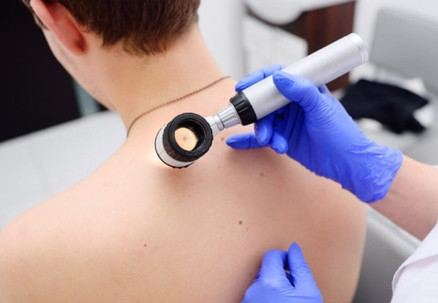 Full Body Skin Cancer Assessment with a Skin Cancer Doctor incl. Consultation & Skin Cancer & Melanoma Check with Dermatoscope