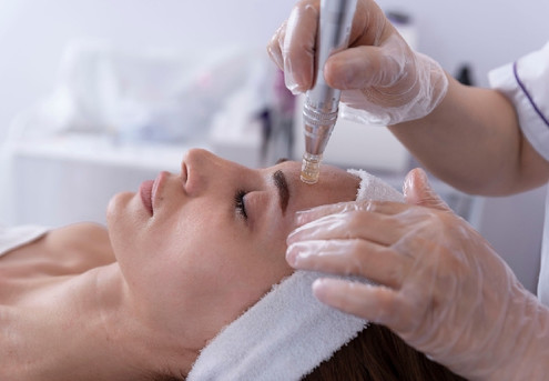 Micro-Needling Session - Option to Include Cleansing & Light Therapy