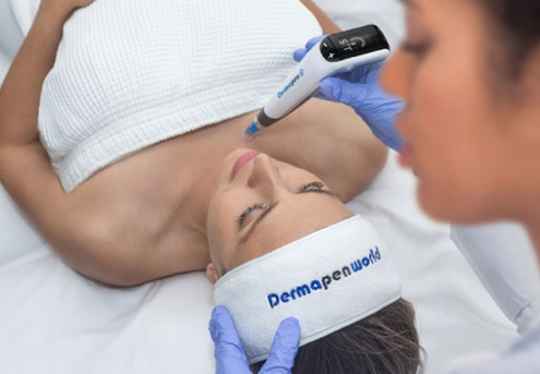 One Dermapen4 Microneedling Face Treatment – incl. Take Home Product Kit – Option for Three treatment and neck and decolletage treatment