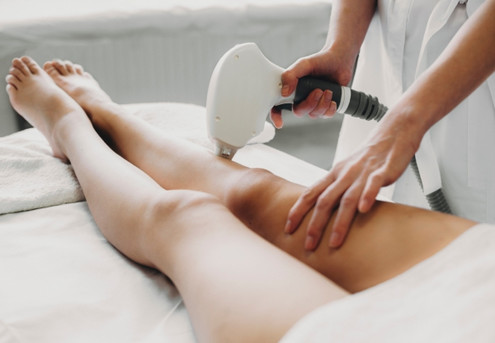 Diode Laser Hair Removal Session - Options for Arms, Legs, Stomach, Back, Bikini & Brazilian