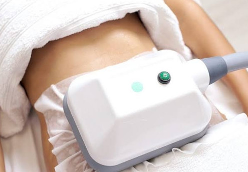 Cooltech Fat Freezing Session - Consultation & Treatment - Option for Small, Medium or Large Area