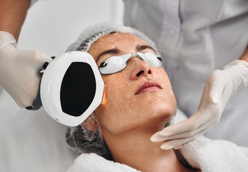 30-Minute IPL Photorejuvenation Treatment - Options for 45-Minute IPL & Infused Algae Mask or 45-Minute IPL & Skin Sonophoresis Hydrating Mask