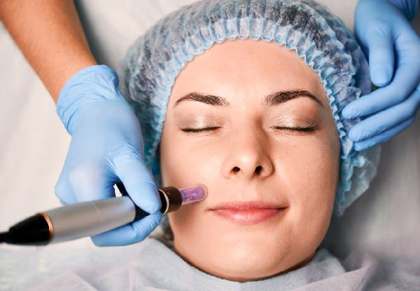 Collagen Induction Facial with Microneedling - Option for Collagen Induction Facial with Microneedling & Mask - Choose from Face, Face & Neck, or Face, Neck & Chest
