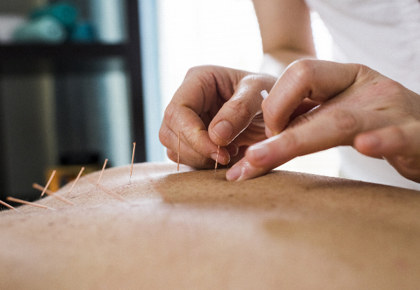 60-Minute Acupuncture Session