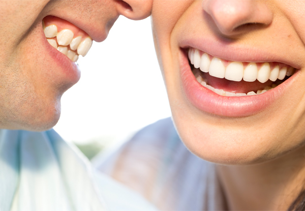 $169 for a One-Hour In-Chair LED Teeth Whitening Treatment (value up to $299)