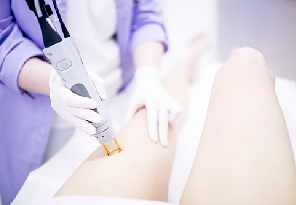 Three Laser Hair Removal Sessions on Two Areas for One Person - Options for Three Areas or Half Legs