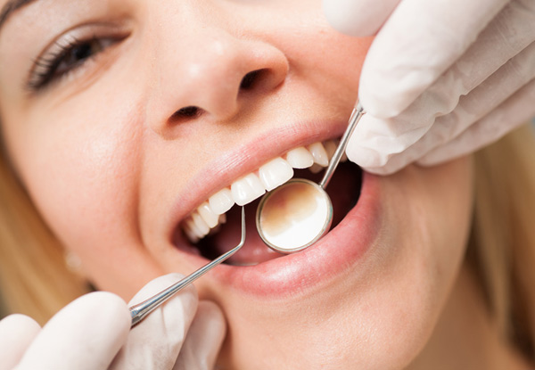 Dental Exam & One Filling Package - Options Two Fillings Available