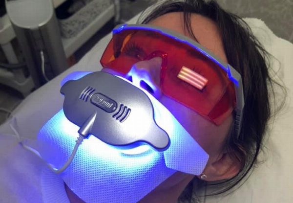 One Ultra Sonic Vibration Teeth Whitening Session incl. Consultation