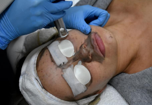 60-Minute Oxygen Hydro Facial - Option for 50-Minute Carbon Facial