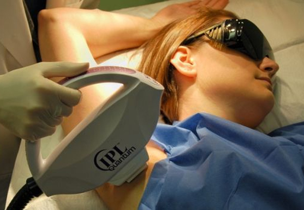 $1,000 IPL Hair Removal &/or Skin Rejuvenation Voucher - Options for up to a $5,000 Voucher