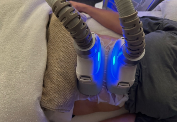 40-Minute Thermal Shock Fat Freezing Session