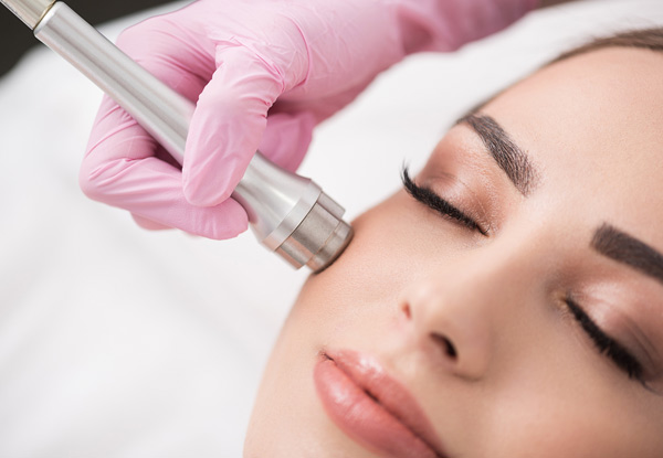 Diamond Microdermabrasion Treatment incl.  Express Facial