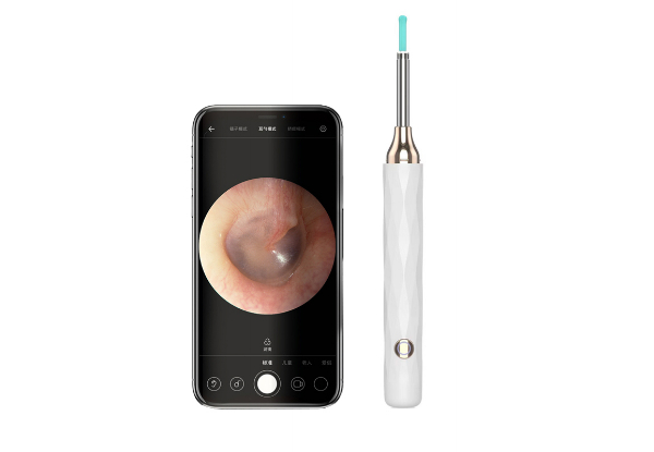 Visual WiFi Ear Wax Removal Tool with LED Light - Available in Three Colours & Option for Two-Pack