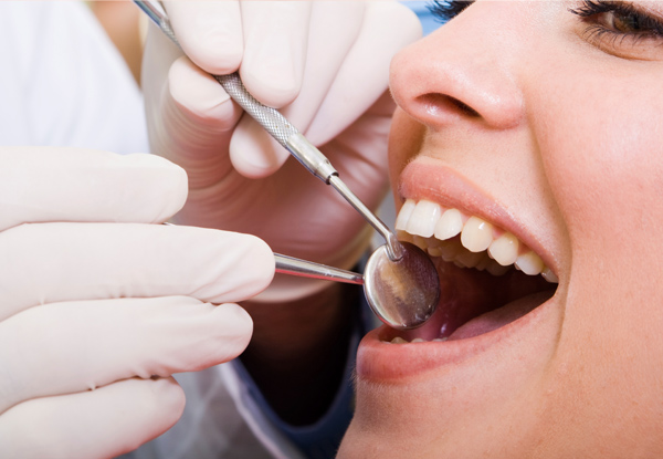 Dental Exam incl. X-Rays, Clean, Scale & Polish - Three Waikato Locations