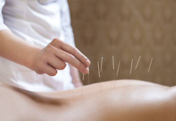 60-Minute Acupuncture Treatment - Option for ACC Injury Treatment, Acupuncture & Cupping, Acupuncture & Massage and Acupuncture Treatment