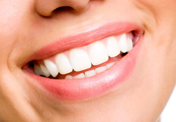 From $50 for a 60-Minute Professional Teeth Whitening with Options for One & Two People