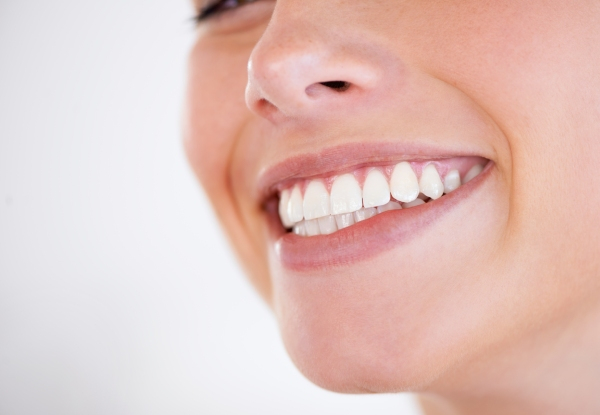 Certified Teeth Whitening Package incl. Full Three Cycle Whitening for One Person - Option for Freshen-Up Treatment