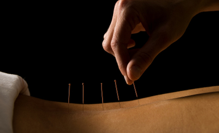 $25 for a 60-Minute Acupuncture Session or a 30-Minute Chiropractic Session or $45 for Two Sessions