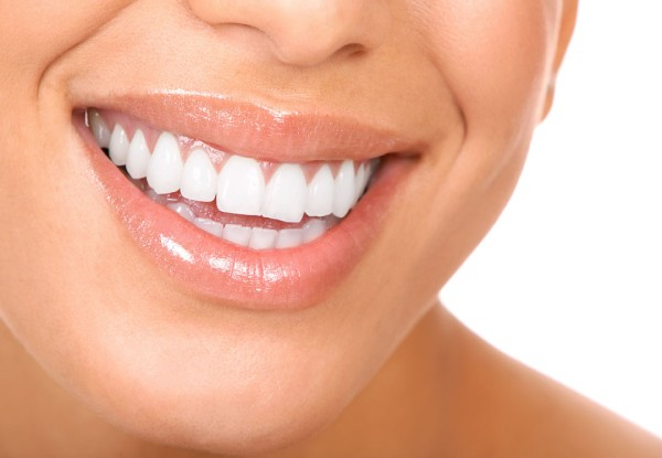 30-Minute Laser Teeth Whitening Treatment - Option for 60-Minute Treatment