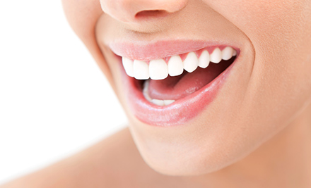 $39 for an At Home Teeth Whitening Kit (value $69)