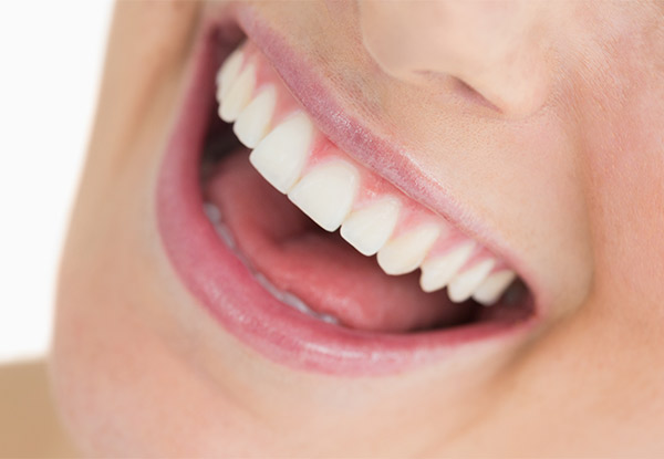 $115 for One Teeth Whitening Session, $125 for One Teeth Whitening Session for Sensitive teeth or $129 for One Session & a Take Home Whitening Pen (value up to $145)