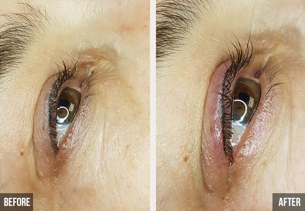 Henna Brow Treatment - Options for Yumi Lash Lift, Nano Eyeliner, Microblading, Powder Brow or Powder Brow & Microblading Combo incl. A 20% Discount Off Your Follow Up Treatment