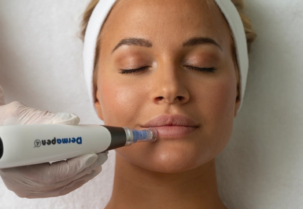 Dermapen Beauty Package - Options for DP Advanced Facial Package, 45-Minute Facial Dermapen Microneedling Treatment, or Three Sessions of Facial Dermapen Microneedling Treatments