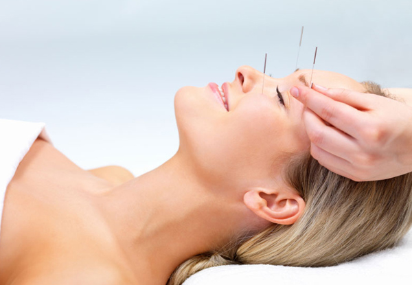 One-Hour Acupuncture Session or Traditional Chinese Massage - Options for Three Acupuncture Sessions