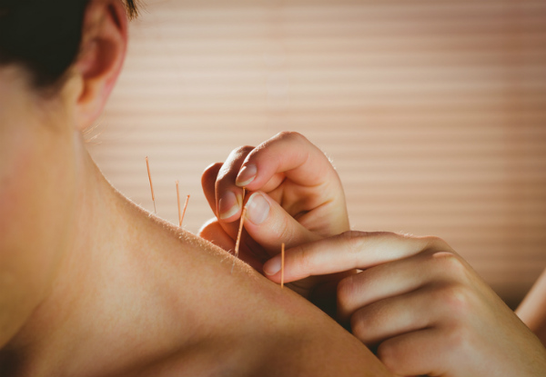 One 60-Minute Acupuncture Session - Options for Two or Three Sessions