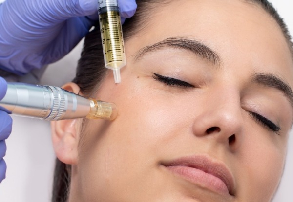 Meso Microneedling Collagen Induction Treatment-  Options for up to Three Treatments & to Include a Free Gel Polish Manicure
