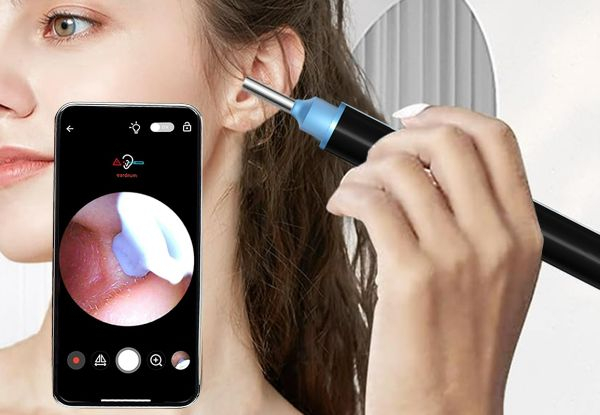 Visual Wi-Fi Ear Wax Remover Kit - Available in Two Colours & Options for Two-Set