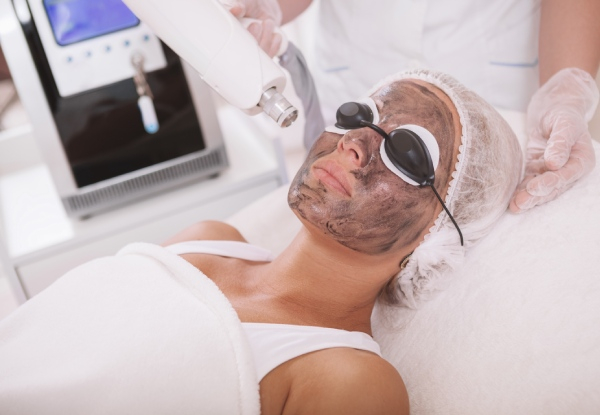 One Session of Full-Face Carbon Laser Peel Treatment for One Person - Option for Three Sessions