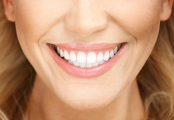 Two Cycles of Light to Medium Staining Teeth Whitening Treatment for One Person - Options for Heavy Staining or Touch Up Whitening