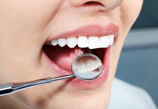 $59 for a Dental Scale, Clean & Polish for One Person or $110 for Two People with Free Full Mouth Exam