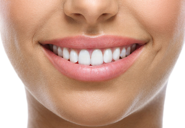 Dental Implant incl. X-Ray & Crown with options for up to Four Implants - Two Auckland Locations
