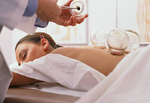 45-Minute Acupuncture for One Person - Option to incl. Cupping, Massage or for Any Three Sessions