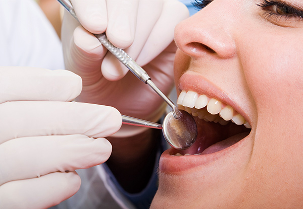 Dental Exam & Two X-Rays - Options for Fillings Available at Multi-Location