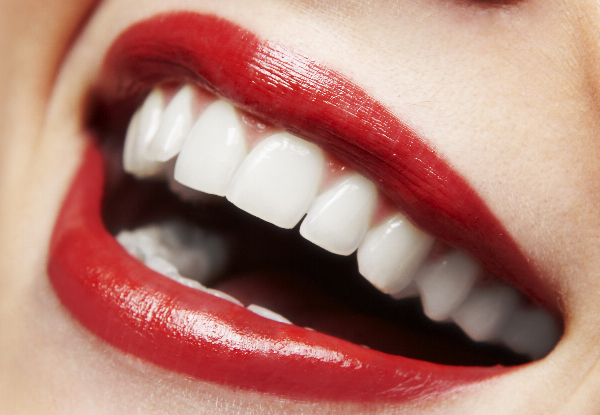 75-Minute Certified Teeth Whitening incl. Consult & Aftercare - Option for 90-Minute & to incl. a Take Home Kit - Kapiti Coast Location