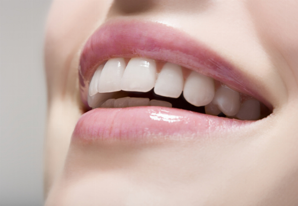 75-Minute Professional Teeth Whitening Package. incl Consultation & Triple Treatment for One Person - Options for 90-Minute Heavy Staining Treatment & Two People