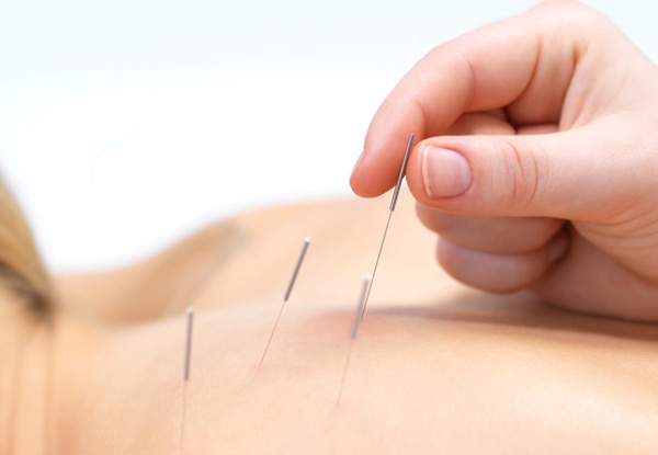 Therapeutic Treatment Packages incl. Chiropractic Consultation, Assessment, X-Rays, Adjustment & Acupressure Massage - Options for One, Two or Three Appointments or Acupuncture Treatment