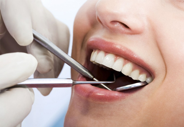 45-Minute Dental Check-Up, X-Rays, Clean, $50 Voucher & 20% Off Your Next Treatment
