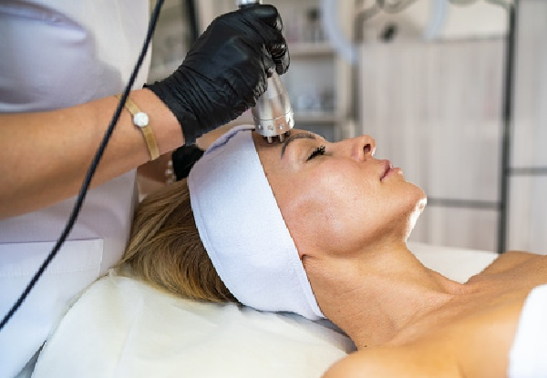 One Session of Radio Frequency Skin Tightening for Double Chin - Options for Full Face or Stretch Marks for Stomach & Thighs