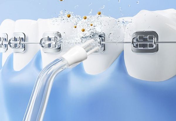 Cordless Water Dental Flosser with Four-Tips - Available in Four Colours & Option for Two-Pack