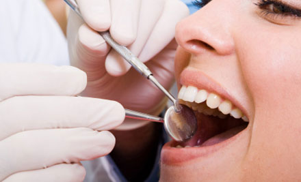 $59 for a Dental Clean, Scale & Polish (value up to $90)