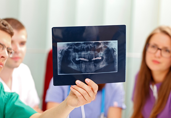 60-Minute Dental Service incl. X-Rays, Scale & Polish - Valid Thursday & Saturday