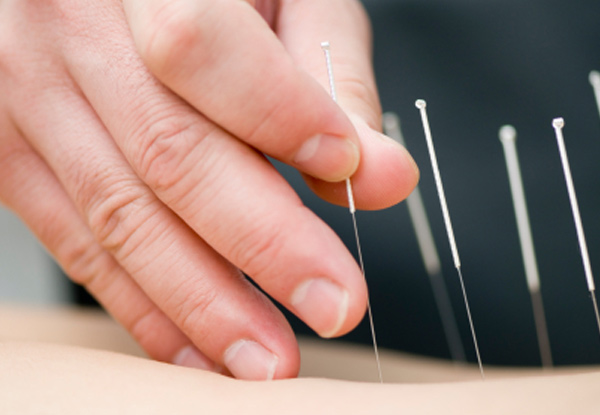 $36 for a Massage or Acupuncture Treatment – with Eight Options Available & Multiple Sessions (value up to $2,500)