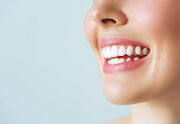 Teeth Whitening at Phoebe's Beauty Parlour - Option for Glam White Treatment, Hollywood White Treatment or Top-Up Treatment