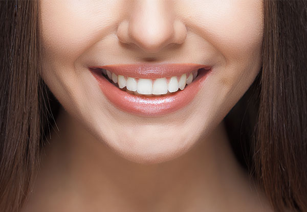$89 for a 60-Minute Sensitivit- & Pain-Free LED Teeth Whitening Package, $129 for 75 Minutes or $149 for 90 Minutes - Four Wellington Locations  (value up to $649)